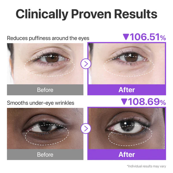 Numbuzin No.9 NAD+ Collagen Under Eye Patches - 5 Pairs